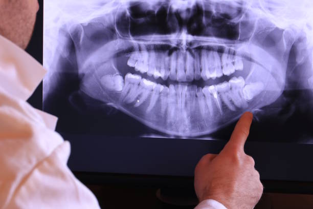 Best Knocked-Out Tooth (Avulsed Tooth) Treatment in Woodcrest, CA